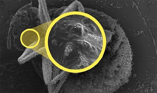 Страшные бактерии под микроскопом