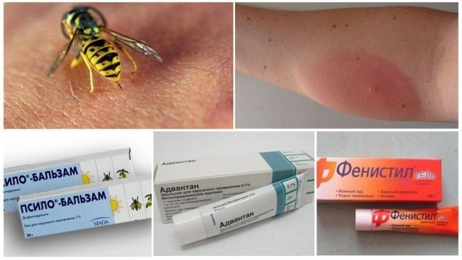 Мазь от аллергии от укусов насекомых